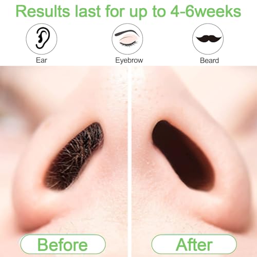 Nose and Ear Hair Waxing Kit - Hair Removal Set for Men and Women with 50g Wax Beads, 20 Applicators (10 times), 10 Paper Cups, and 10 Mustache Guards