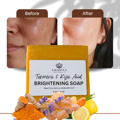 Ammoya Naturals Turmeric Skin Cleansing Soap Pack of 3 - Natural Face & Body Bar for Acne, Dark Spots & Scars - 4.5 oz each