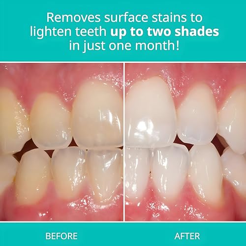 Opalescence 4.7oz Whitening Toothpaste Mint Pack of 2 - Effective Oral Care