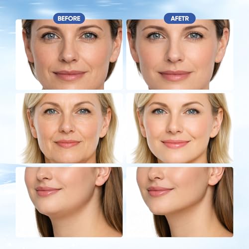 Double Chin Lifting Mask, Firming Mask for Face and Neck Lifting, Tightening and Firming For Women (4PCS)