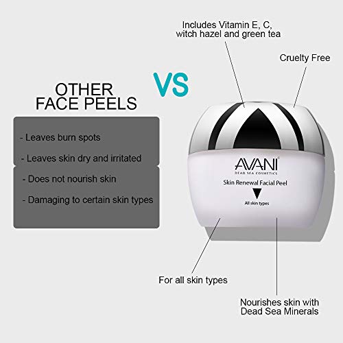 Avani Classics Skin Renewal Facial Peel 1.7oz - Anti-Aging Exfoliating Cream with Vitamin C & Dead Sea Minerals