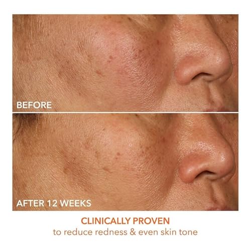 Dr Dennis Gross Vitamin C Lactic 15% Firm & Brighten Serum