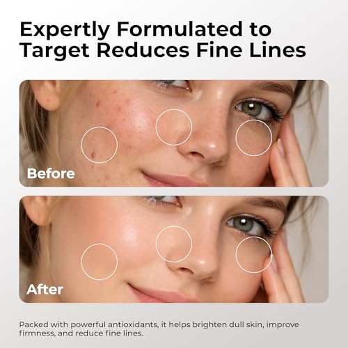 Skin Deva 10% Vitamin C Serum with Vitamin E & Ferulic Acid - 1 Fl Oz
