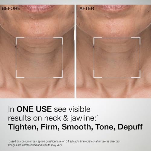 StriVectin Tighten and Lift Advanced Neck Cream PLUS with Alpha-3 Peptides for Neck and D?collet?, Smoothing Look of Wrinkles and Fine Lines, Improves Crepey Skin and Vertical Lines