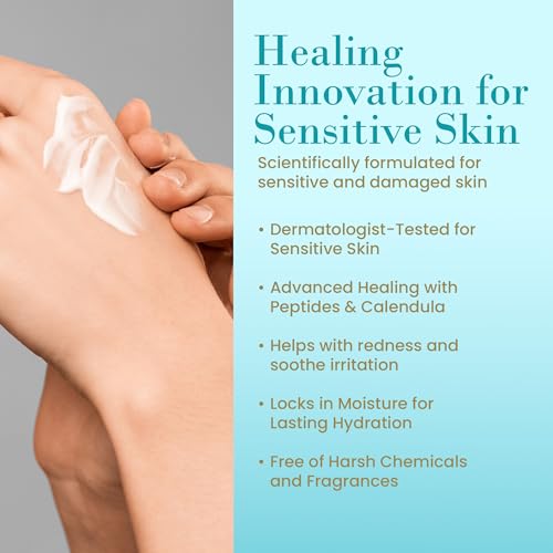 RemeVerse Radiation Cream - Unscented, Hydrating Skin Care for Burns & Sensitive Skin - 6 fl oz - Variation of Radiation Cream