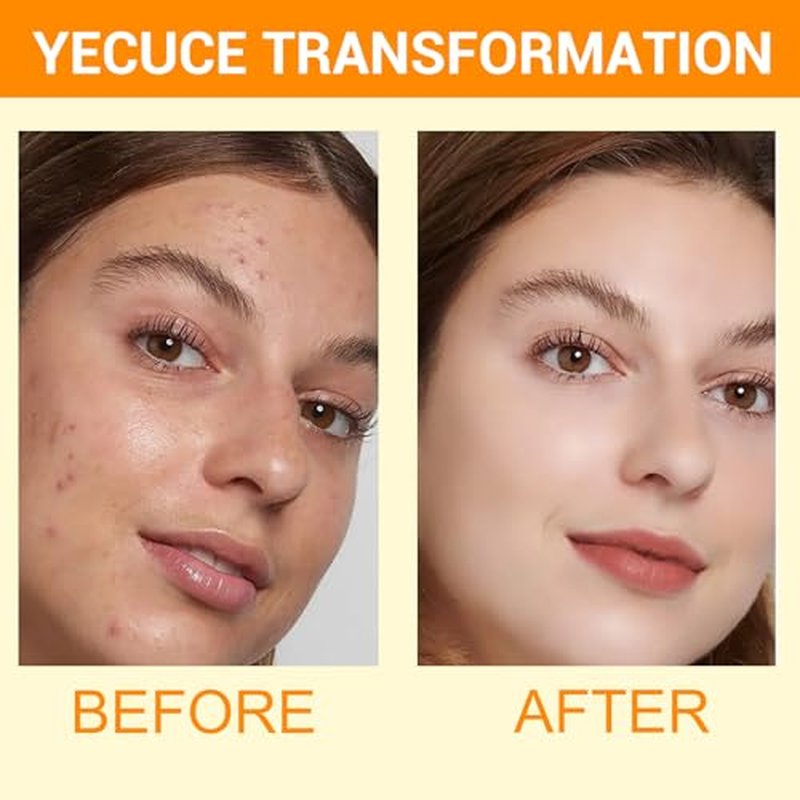 2 Pack Turmeric Cleansing Mousse,Kojic Acid Facial Cleanser for Fce Wash and Firming Skin,Remove Excess Keratin-Deep Clean Pores 150ML
