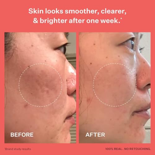 Glass Skin Serum with Hyaluronic Acid & Niacinamide - Sensitive Skin, 1.35 oz