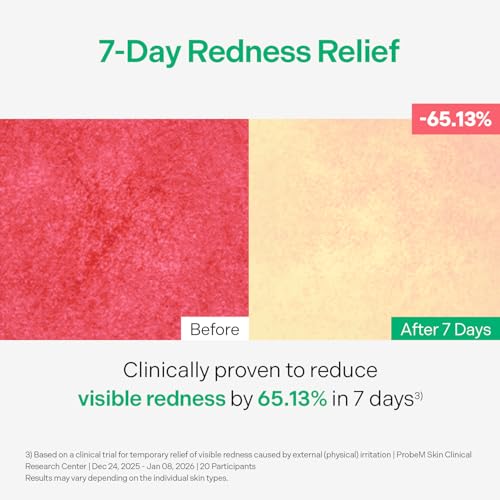 Torriden Azelaic Acid Mask - 10 Sheets for Brightening & Oil Control