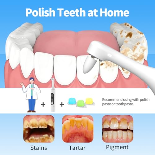 JUSIIUE Rechargeable White Tooth Polisher Kit with LED Light & 6 Heads