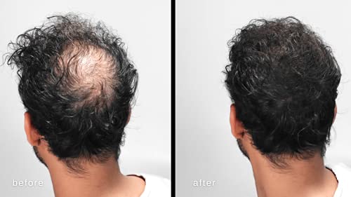 Hair Building Fibers for Thinning Hair - Natural Thickening - Dark Brown - 2 Months+ Supply