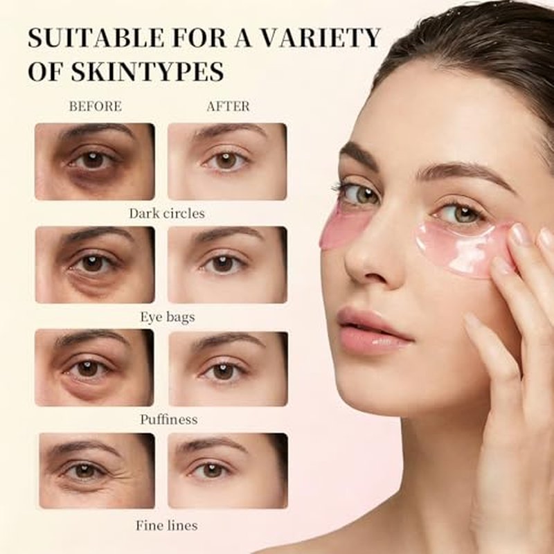 16 Pairs Instalift Pdrn & Collagen Eye Patches£¬Instant Anti-Wrinkle Eye Mask for Dark Circles & Puffy Eyes£¬Hydrogel Undereye Patches with Hyaluronic Acid£¬Quick Fix & Long-Term Care ? (2)