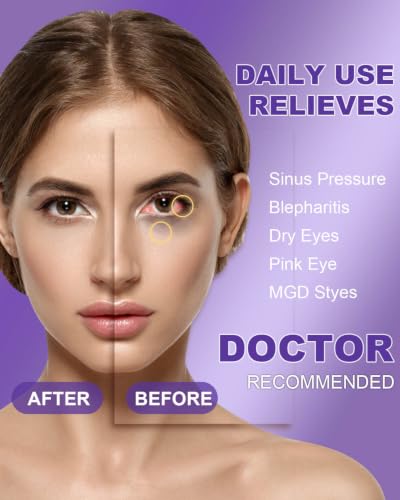 Lavender Steam Eye Mask 30 Pack - Warm Compress for Dry Eyes & Relaxation
