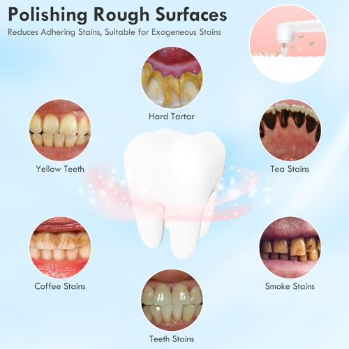 Pelzzle White Electric Tooth Polisher with 5 Modes & 3 Pastes for Daily Teeth Cleaning