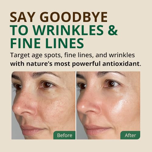 Vitamin E Oil 2 Fl Oz - Pure Natural Skin Repair & Moisturizer - Variation of THIS listing