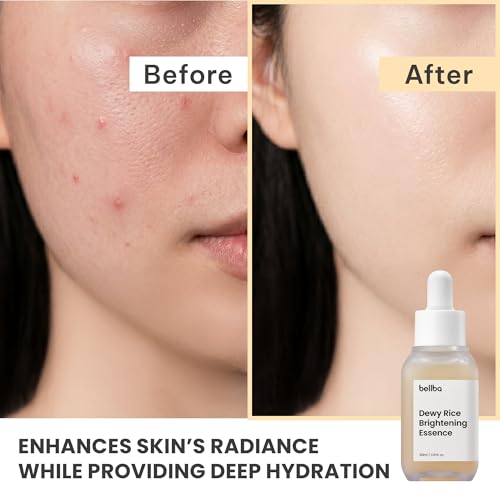 Dewy Rice Glow Serum - Korean Face Serum with Niacinamide & Hyaluronic Acid