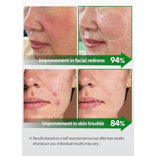 BEAUDIANI CICA Ampoule Mask Pads (Spot Mask) ? Round Pre-Soaked Calming Pads with 3,026 PPM Centella Asiatica, 5-Hyaluronic Acid & Peptide Complex, Low-Irritation Tested, 100 Pads / 150ml