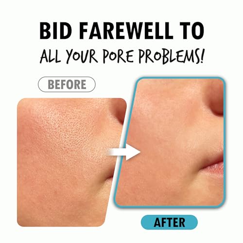 Pore Refining Serum for Face - Hydrating & Minimizing Pores, Korean Skincare
