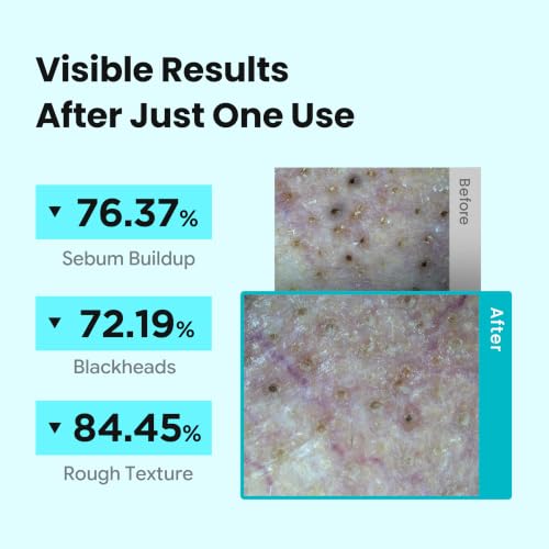 ILSO Melting Sebum Softener 5.07 fl oz with Skin Wrap Pads - Pore & Sebaceous Filament Care