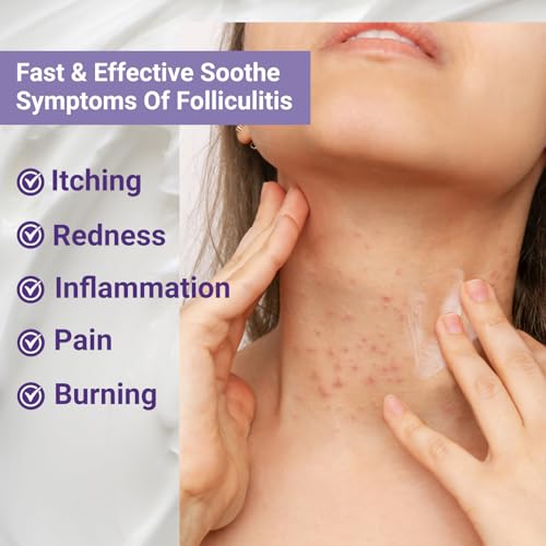 Folliculitis Treatment Cream - Natural Relief for Itching Redness & Inflammation - 3.53 Oz - Variation 1