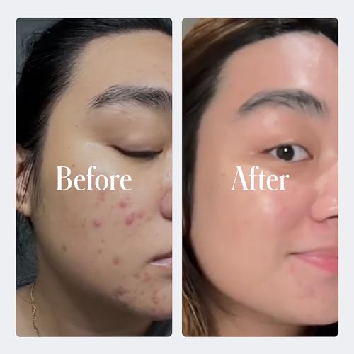 Geologie Ultra Strength Retinol Face Cream - Anti-Aging Night Moisturizer for Men & Women