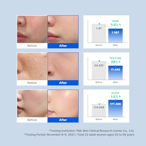 idplacosmetics Real After Care Bubble Glow Toner 5.07 fl.oz (150 ml) ? Micro-Bubble with 42% Rice Bran Water & Gentle AHA/PHA/LHA Exfoliation Hydrating Korean Toner for Smoother Look