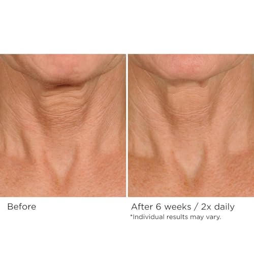 NassifMD Deco-Lift Neck & Décolleté Firming & Lifting Complex 1.7 Fl Oz