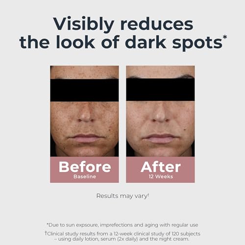 Dark Spot Corrector Face Lotion with SPF 30 - Radiance & Moisturizer