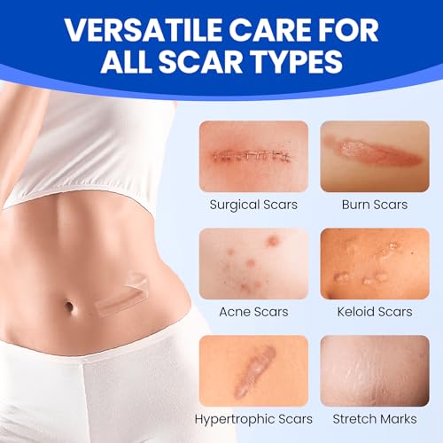 Silicone Scar Sheets Surgical Tape (1.6¡±x120¡± Roll) Face Patches Acne Treatment C Section Strips, Skin-Sensitive Medical Grade Healing Scar Bandages Pads for Keloid, Stretch and Tummy Tuck Recovery