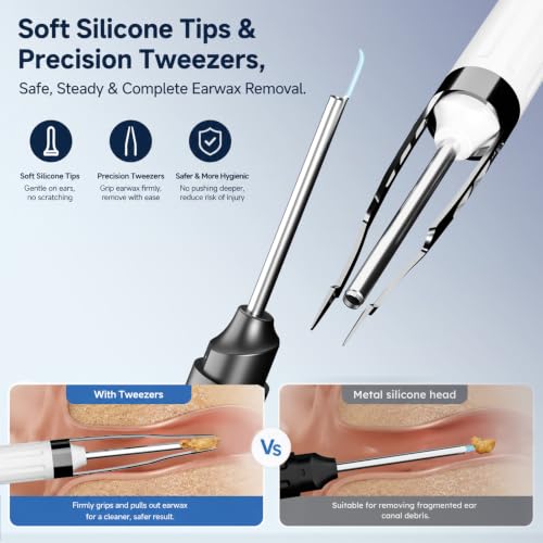 Wireless Ear Otoscope with 4.3-Inch HD Screen and Ear Wax Removal Kit