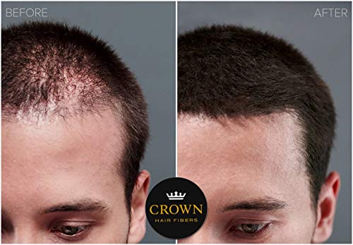 CROWN TWENTY1 Hair Building Fibers - 2 x 28g Black Hair Concealer for Thinning Hair