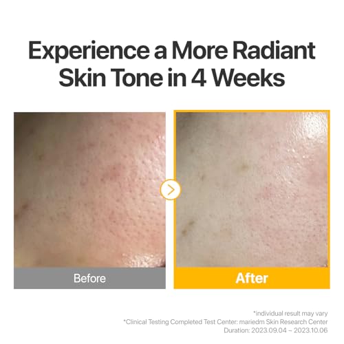 Vitamin Boost Sheet Mask Pack of 2 - Glutathione & Vitamin C for Radiance & Hyperpigmentation