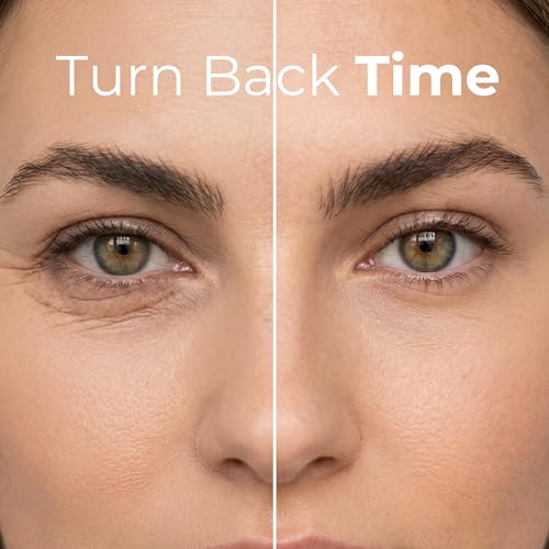 Retinol Eye Cream for Firming & Brightening - Reduces Dark Circles & Wrinkles