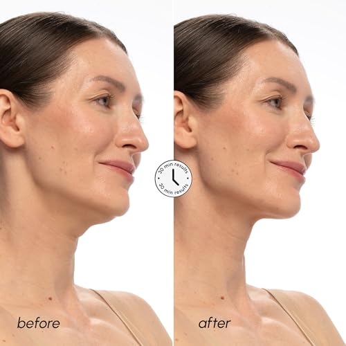 MAREE V Line Lifting Face Mask with Salmon DNA - 10 Pack, Collagen & Retinol