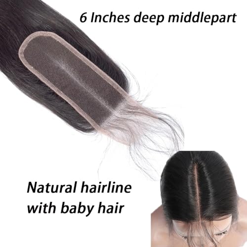 FEHOKA 10 Inch 2x6 Brazilian Body Wave HD Lace Closure for Black Women Middle Part
