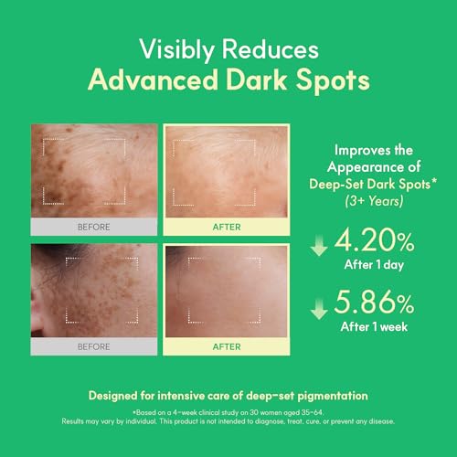 Easydew DW-EGF Melatoning Ampoule 5X - Hydrating Dark Spot Serum with Niacinamide & Glutathione for Uneven Skin - Fast Absorbing Day & Night Ampoule Korean Skin Care (Bottle 1.01 fl oz, EGF 5X)