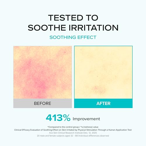 Azelaic Acid Serum 10% for Blemish-Prone Skin - Lightweight, Soothing & Pore Refining