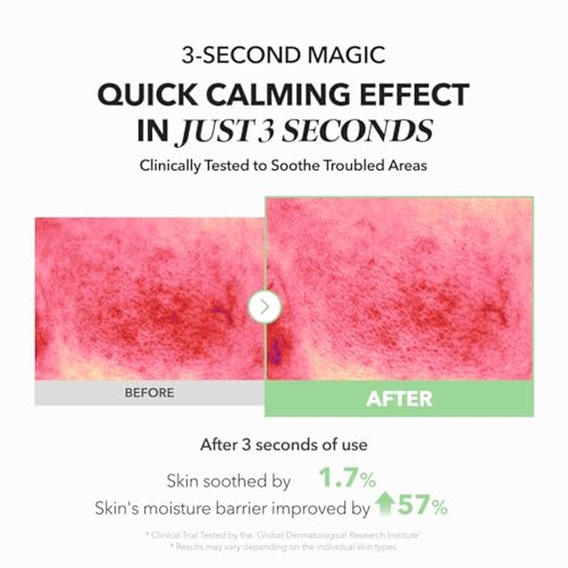 APRILSKIN A.C.E Serum£üMugwort Centella Serum for Soothing & Calming£ü3-Second Claming£üMugwort Leaf Water 50% + Centella Leaf Water 40% for Troubled Skin£üKorean Skin Care£ü3.88 oz