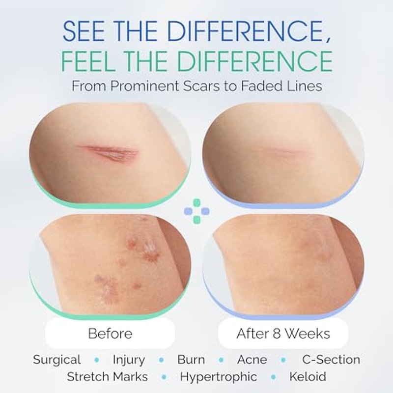 100% Silicone Scar Gel Serum ? Ultra-Soft Brush Applicator for Cosmetic Procedures & Facial Peels, Gentle Scar Care for Surgical, Acne, Burn & Keloid Scars ? Hypoallergenic & Fragrance Free