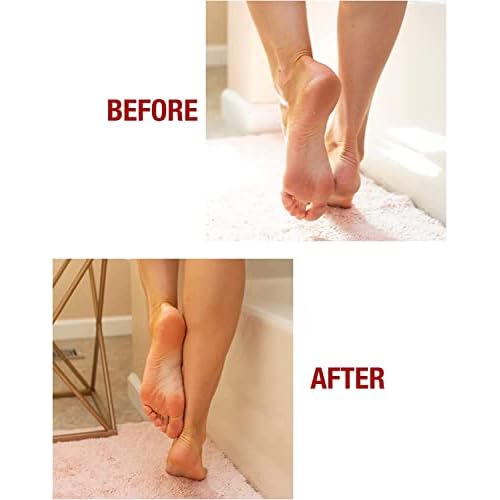 Kerasal Intensive Foot Repair Skin Healing Ointment,1 Oz and Moisturizing Gel Socks,(Packaging May Vary),(Pack of 4)