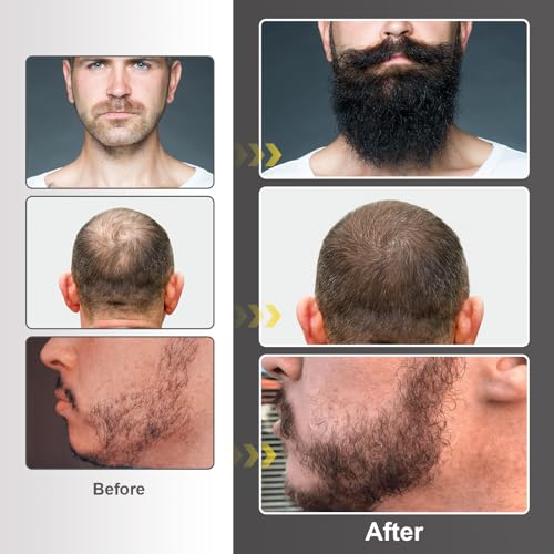 Naland Beard Growth Kit with Oil, Balm, Comb & Massager for Men - Fuller Beard Care