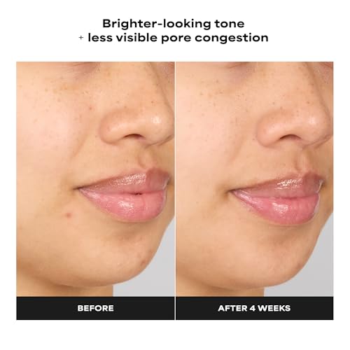 Paula's Choice 4% BHA Exfoliating Serum Toner for Clear & Smooth Skin, 1 fl oz