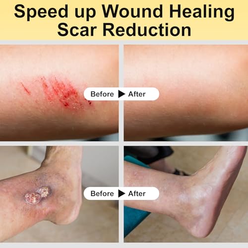 Manuka Honey Wound Care Ointment for Cuts, Burns & Ulcers - 3.88 oz