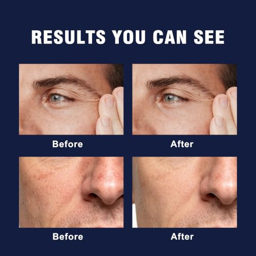 Men's 6-in-1 Face Moisturizer & Anti-Aging Cream - 1.7 Fl Oz Pack of 2