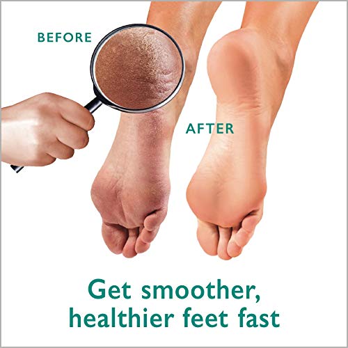 Foot Care Gel & Scrubber Set with Shea Butter - Callus Softening Bundle