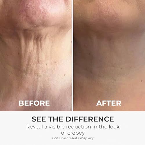 Neck Cream, Tighten & Lift Neck Cream - Anti-Aging Neck Creams for Tightening Lifting Sagging Skin and Hydrating- With Pro-Active Repair Firming Complex, 1.8 oz