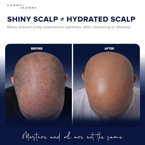 Comme Homme Bald Head Moisturizer 3.4 fl oz - Soothing Scalp Care for Men