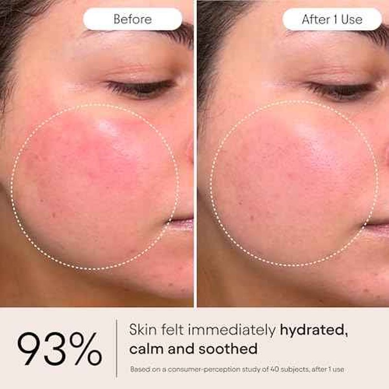 Alpyn Super Peptide & Ghostberry Moisturizer for Eczema, Barrier & Wrinkle Repair | Calm & Soothe Against Redness & Irritation (0.5 Oz)