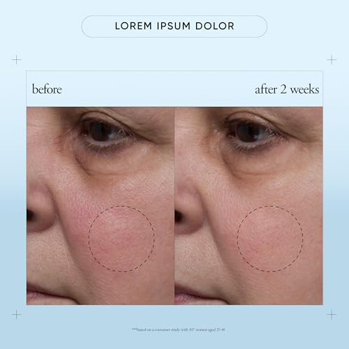 Moisturizer with Hyaluronic Acid & Pro-Vitamin P - 4 Fl Oz - Hope in a Jar