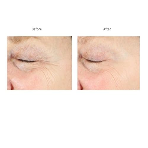 Bluelene EyePlus+, a new formula powered by the ultimate trifecta of Methylene Blue, Ergothioneine, and Niacinamide. Dermatologist approved. Suitable for Sensitive Skin.