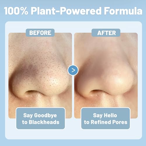 Herbal Blackhead Cleanse Kit Nose Pore Strips, Plant-Powered Deep Cleansing Blackhead Remover Strip Set